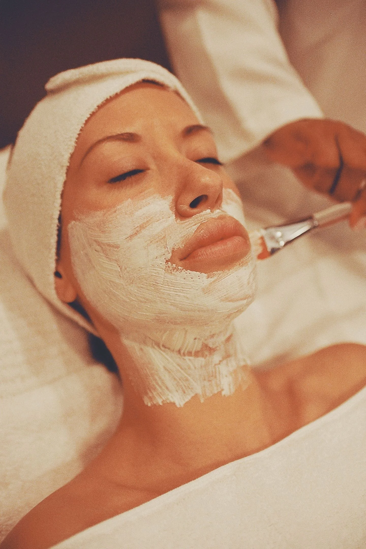 Acne Recovery Journey — after