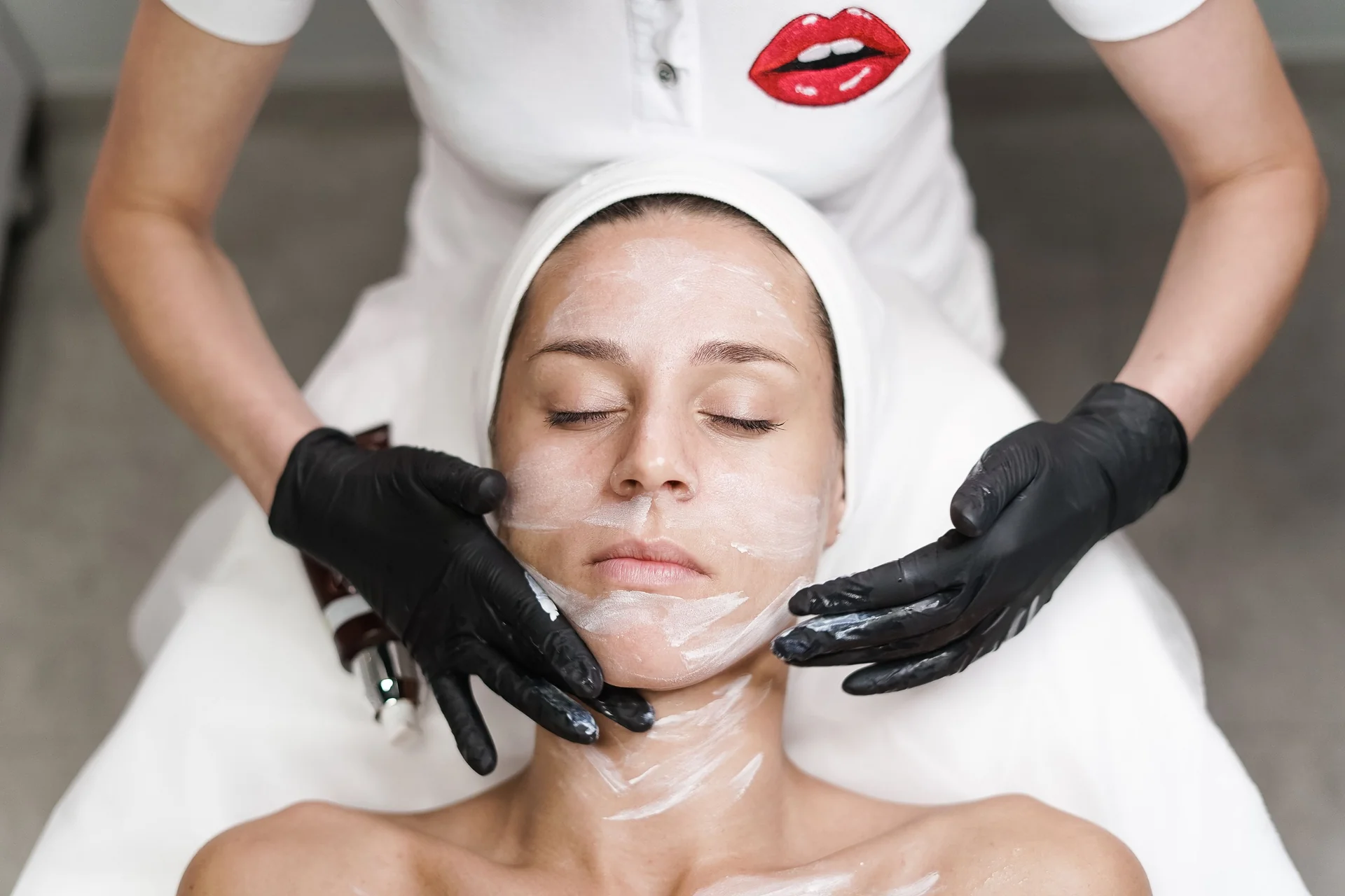 Pigmentation & Laser Resurfacing — before