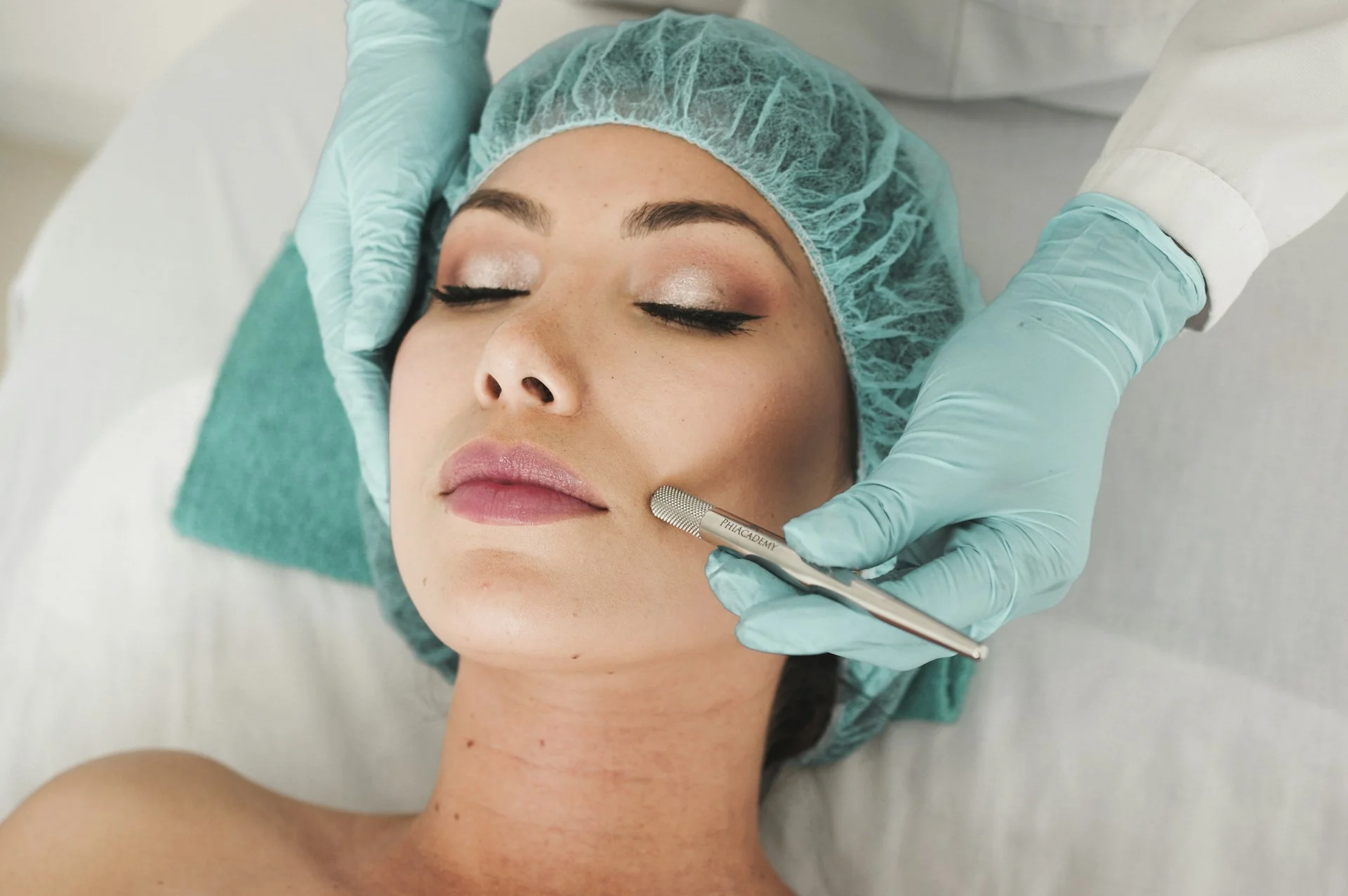 Pigmentation & Laser Resurfacing — after
